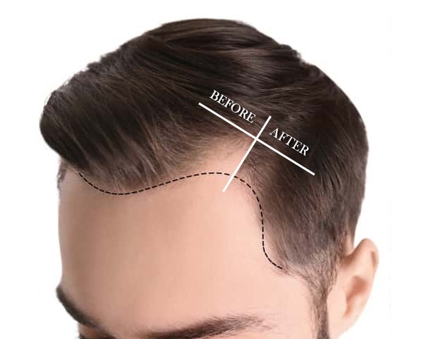 بهترین مدل خط رویش برای آقایان